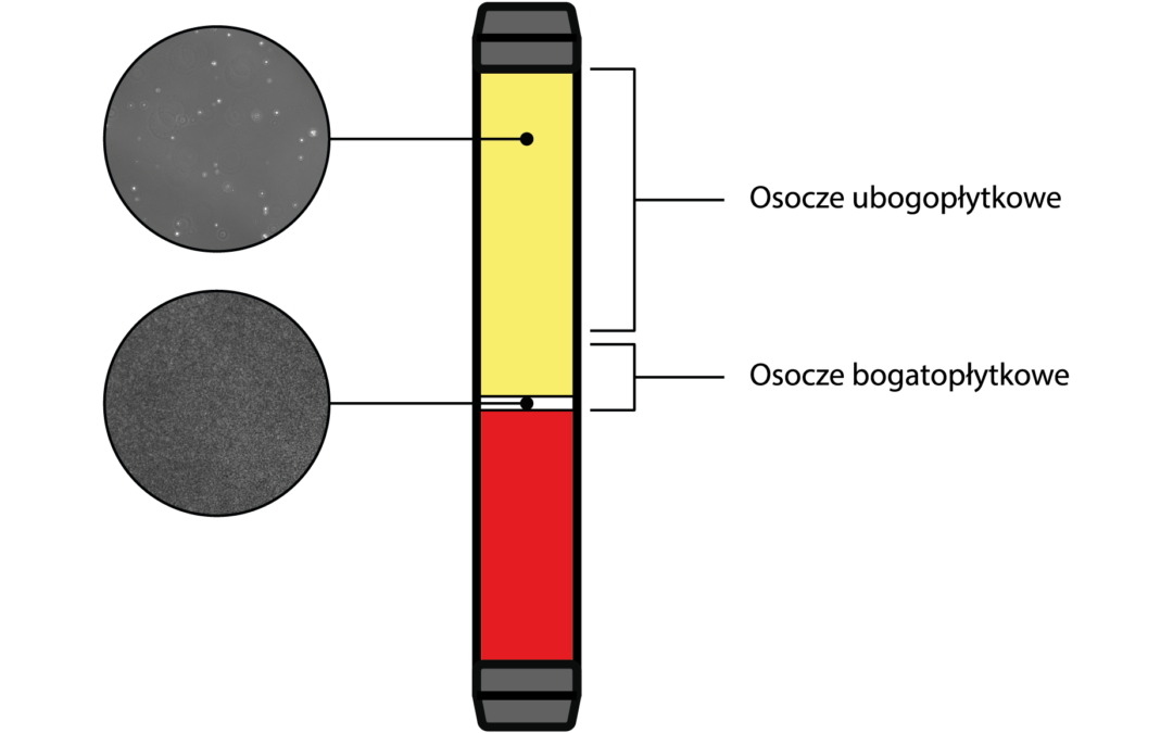 Czym jest osocze bogatopłytkowe (PRP)? I skąd ten cały szum wokół niego?